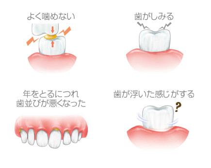歯周病のサイン